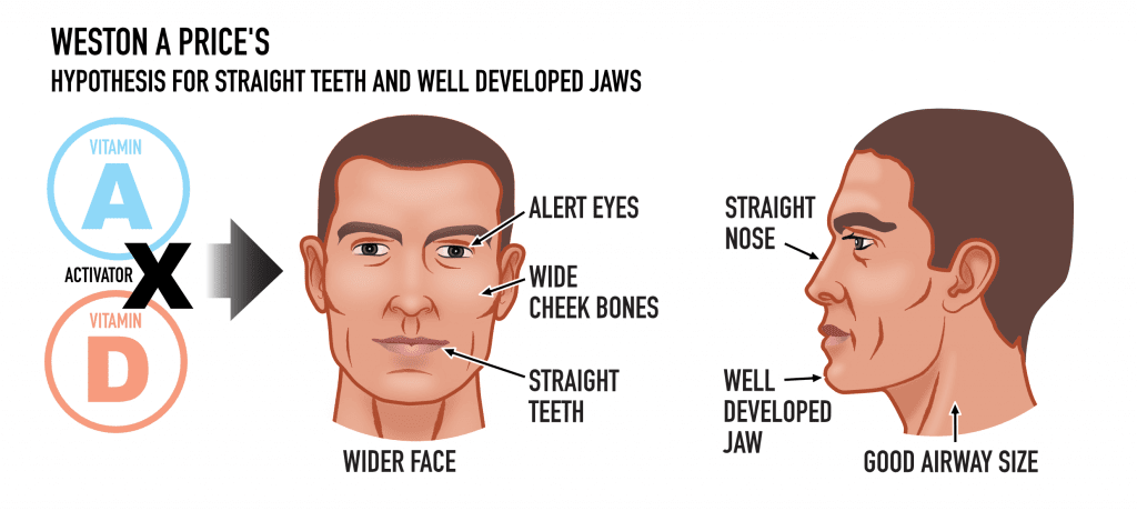 Craniofacial Diagram#1